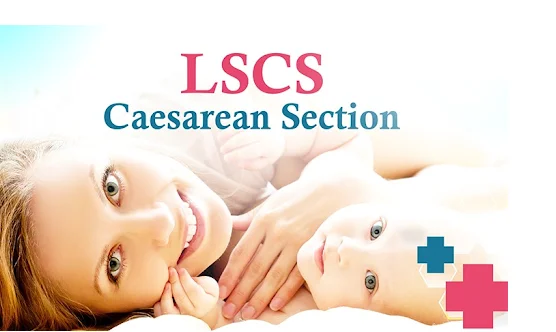 Cesarean Delivery