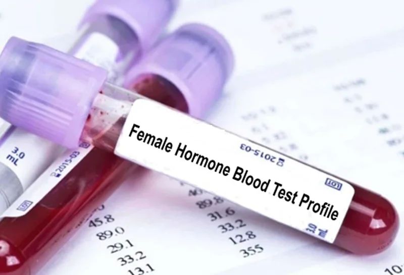 Blood & Hormone Test